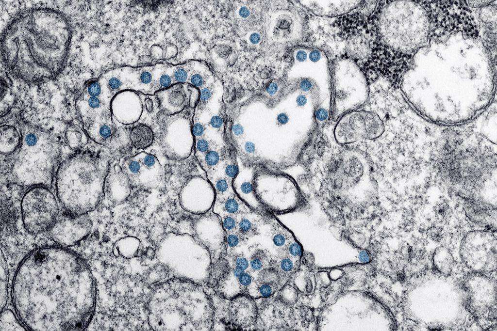 Electron microscope image of a pathogen. New pathogens can be introduced from biodiversity loss