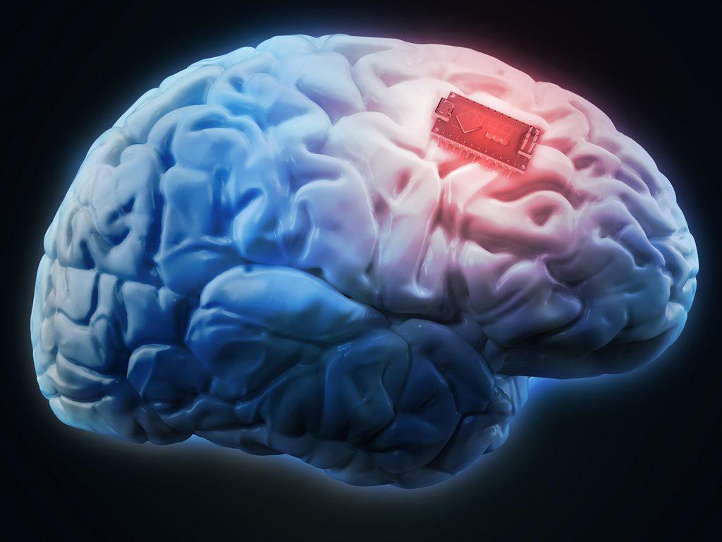 Human brain implant