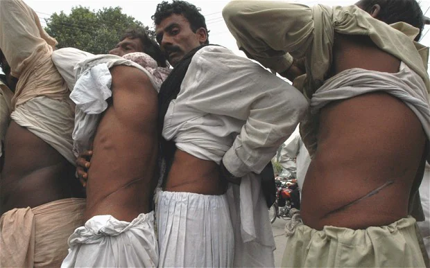 Black market organ trafficking is a huge underground issue in places like India and Pakistan,